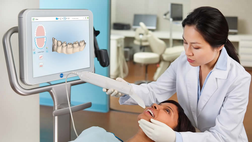 Itero intraoral scanner